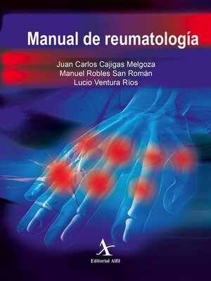 cover image of Manual de reumatología